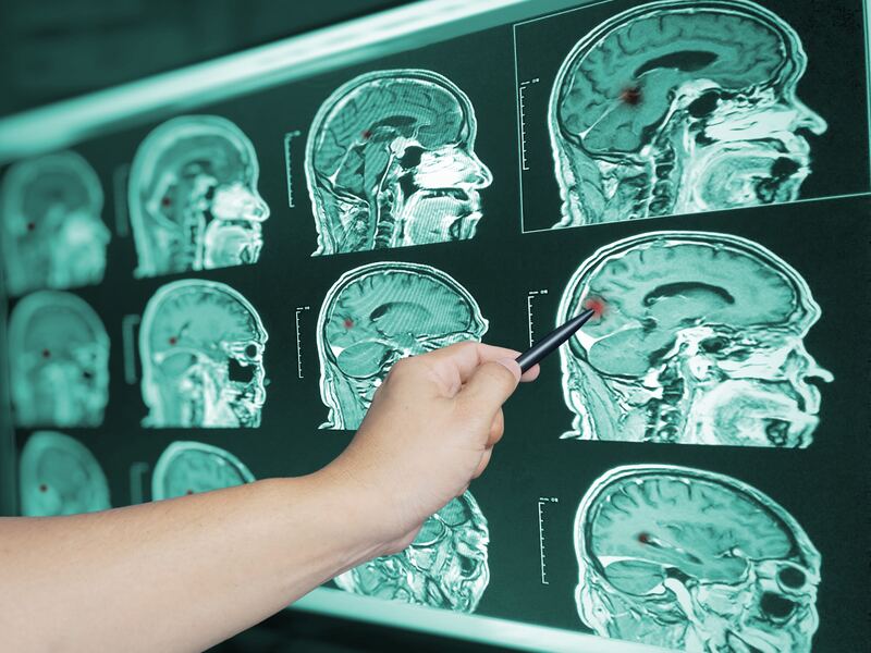 Trauma Injury Lawyer Toronto